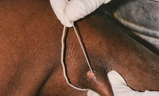 十大最恶心的寄生虫(十大虫子恶心排行榜) 十大最恶心的寄生虫(十大虫子恶心排行榜)