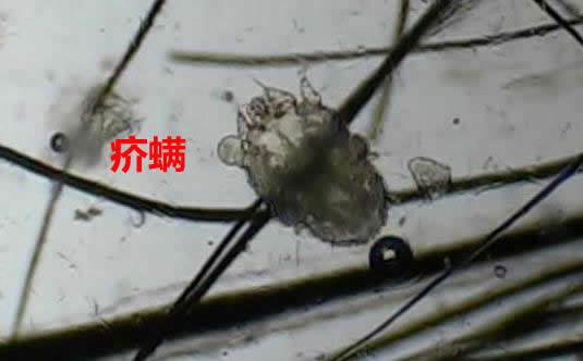 被螨虫叮咬了的症状图片及去除方法汇总