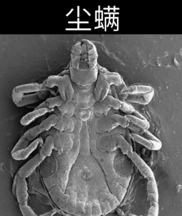 被螨虫叮咬了的症状图片及去除方法汇总