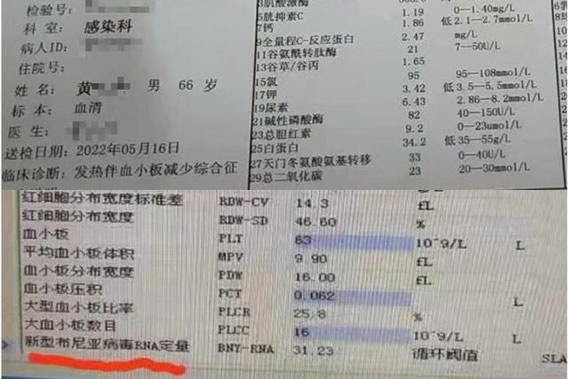 3人因蜱虫病病逝 曾接触去世感染者(蜱虫咬人后症状) 3人因蜱虫病病逝 曾接触去世感染者(蜱虫咬人后症状)