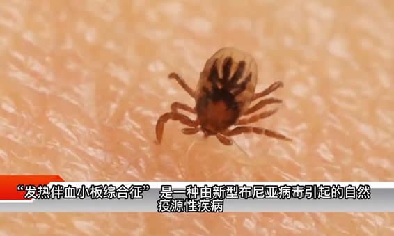 3人因蜱虫病病逝 曾接触去世感染者(蜱虫咬人后症状) 3人因蜱虫病病逝 曾接触去世感染者(蜱虫咬人后症状)