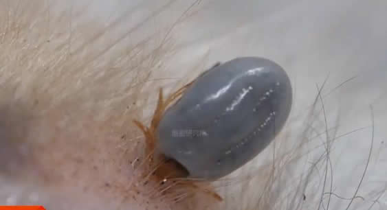 3人因蜱虫病病逝 曾接触去世感染者(蜱虫咬人后症状) 3人因蜱虫病病逝 曾接触去世感染者(蜱虫咬人后症状)