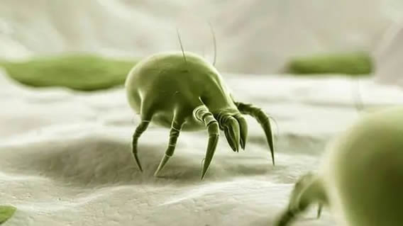 螨虫怎么去除?教你一招轻松搞定(螨虫叮咬症状图) 螨虫怎么去除?教你一招轻松搞定(螨虫叮咬症状图)