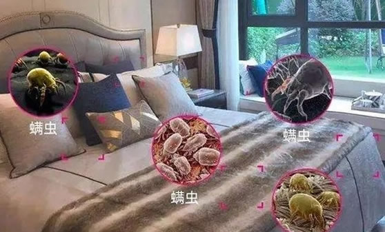 螨虫怎么去除?教你一招轻松搞定(螨虫叮咬症状图) 螨虫怎么去除?教你一招轻松搞定(螨虫叮咬症状图)