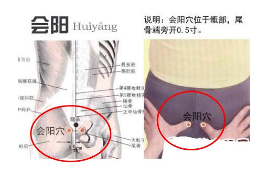 会阳的准确位置图片及作用(男女会阳穴的位置图)
