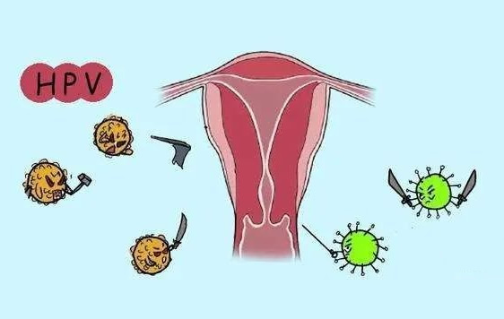 女性hpv最明显的征兆(汇总hpv自查的10个方法) 女性hpv最明显的征兆(汇总hpv自查的10个方法)