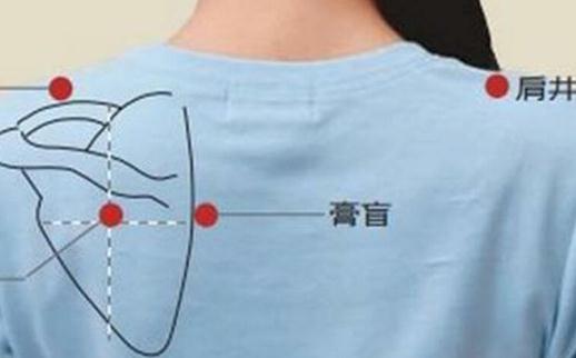 女人三伏贴贴哪个位置图片(常见病症主穴配穴表) 女人三伏贴贴哪个位置图片(常见病症主穴配穴表)