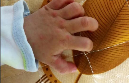 合集18种常见的皮肤病图片(皮肤病照片查病)