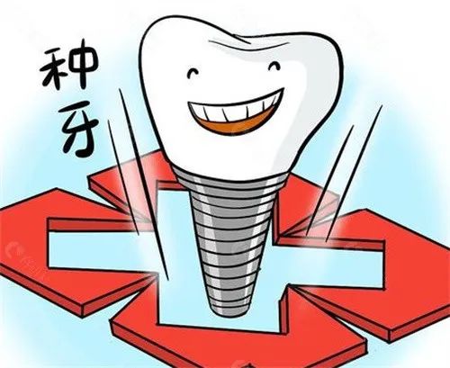 医院种植牙一颗多少钱(从6千到3万不等)