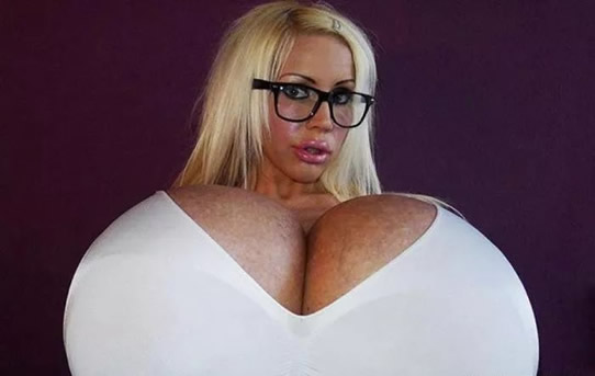 世界上最大胸重排行，安妮·霍金斯特纳胸部重达77斤