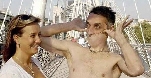 世界上腰最细的人(全球10个罕见身体的人类) 世界上腰最细的人(全球10个罕见身体的人类)