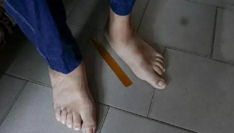 世界上腰最细的人(全球10个罕见身体的人类) 世界上腰最细的人(全球10个罕见身体的人类)