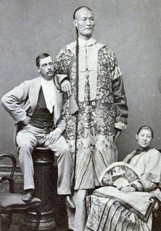 世界上腰最细的人(全球10个罕见身体的人类) 世界上腰最细的人(全球10个罕见身体的人类)