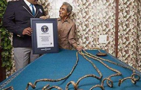 世界上腰最细的人(全球10个罕见身体的人类) 世界上腰最细的人(全球10个罕见身体的人类)