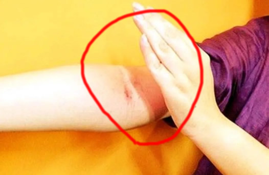 湿气怕的1个动作 来看看这三招排湿气 湿气怕的1个动作 来看看这三招排湿气