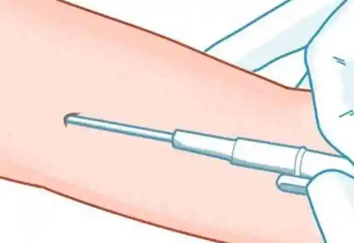 男性避孕针多少钱一针哪里可以打 男性避孕针多少钱一针哪里可以打