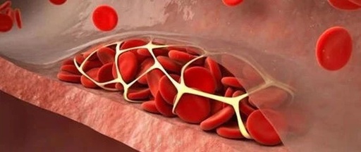 全球十大绝症 狂犬病可防不可治,心脑血管越来越年轻化 全球十大绝症 狂犬病可防不可治,心脑血管越来越年轻化