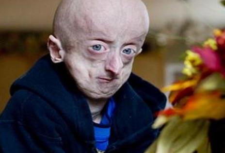 全球十大绝症 狂犬病可防不可治,心脑血管越来越年轻化 全球十大绝症 狂犬病可防不可治,心脑血管越来越年轻化