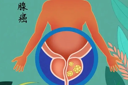 不影响寿命的十大癌症(治愈率高的癌症)