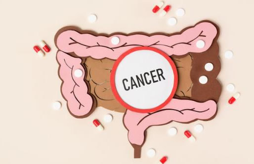 不影响寿命的十大癌症(治愈率高的癌症)