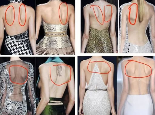 蝴蝶骨是什么样子的图片 具体在什么位置？