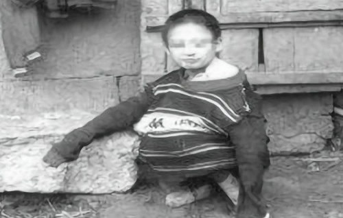 狼孩小杰近况还活着吗(世界真实性狼孩事件)