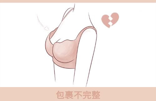 内衣空杯是罩杯选大了吗 内衣空杯什么样子图片