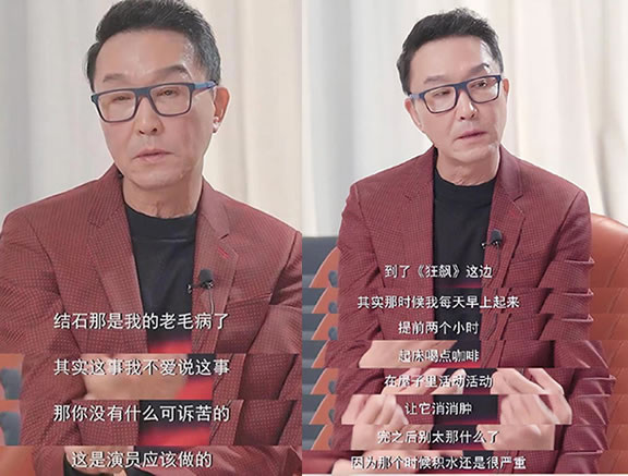 吴刚的脸怎么了 眼睛怎么那么怪双眼皮是割的吗