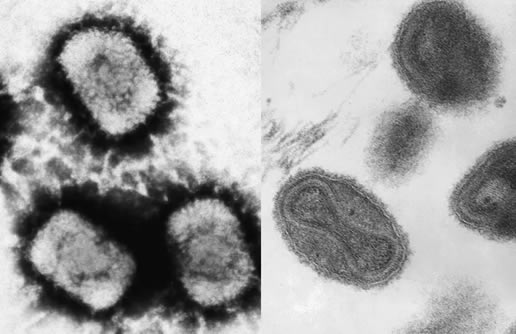 天花是啥病 天花病是什么病呢 天花是啥病 天花病是什么病呢
