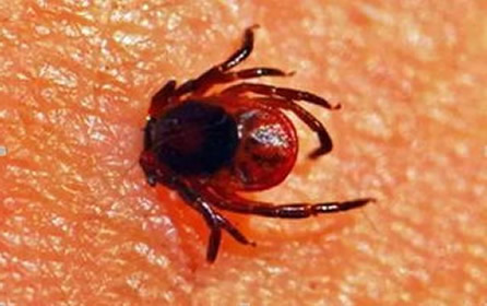 蜱虫最怕这3种东西 蜱虫的天敌(蜱虫咬人后症状) 蜱虫最怕这3种东西 蜱虫的天敌(蜱虫咬人后症状)