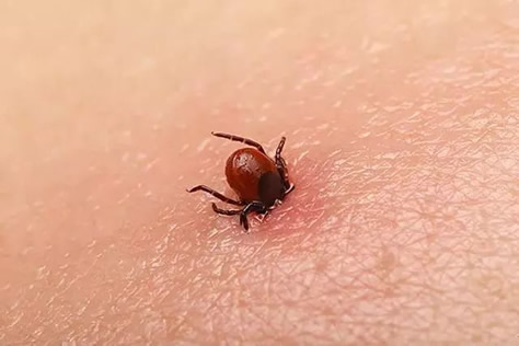 蜱虫最怕这3种东西 蜱虫的天敌(蜱虫咬人后症状) 蜱虫最怕这3种东西 蜱虫的天敌(蜱虫咬人后症状)