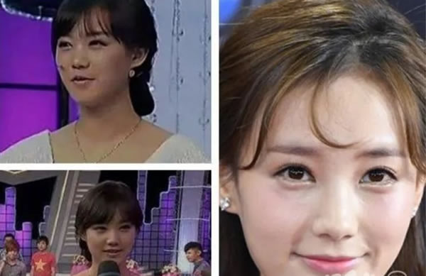 李一桐整容没有早年和近年照对比 李一桐白鹿李沁照片对比