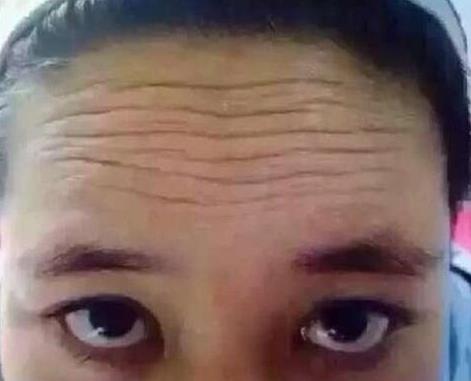 九种皱纹预示着你的健康出现了大问题!(图)