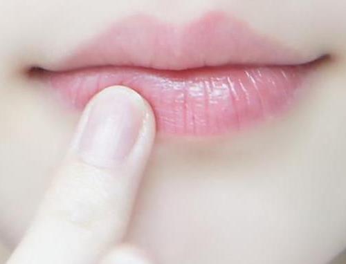 嘴唇干裂怎么办