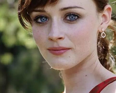 女人如何去脸上的斑 激光去除雀斑安全吗 女人如何去脸上的斑 激光去除雀斑安全吗