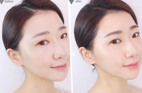 发际线高适合什么发型