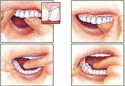牙线的使用方法 牙线的使用方法