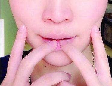 嘴唇干裂起皮?饮食小妙招告别干裂重现水嫩 嘴唇干裂起皮?饮食小妙招告别干裂重现水嫩