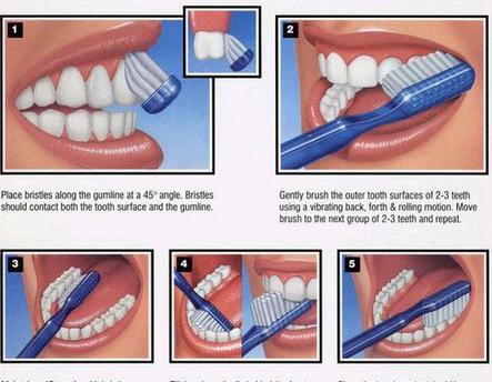 怎样保持牙齿美白
