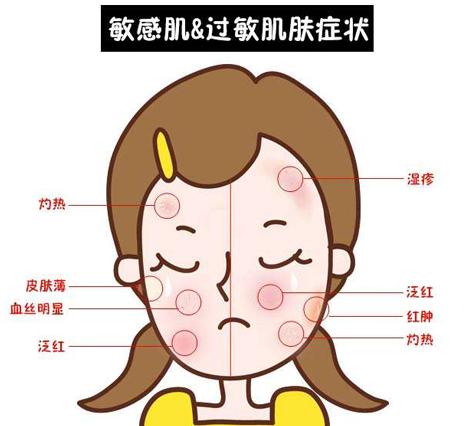 春季皮肤过敏了怎么办？抗敏保养秘诀摆脱敏感君