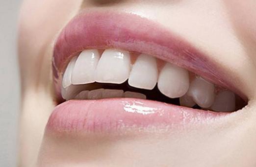 怎样可以美白牙齿