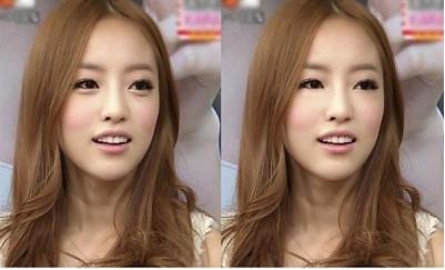 卧蚕和眼袋的区别