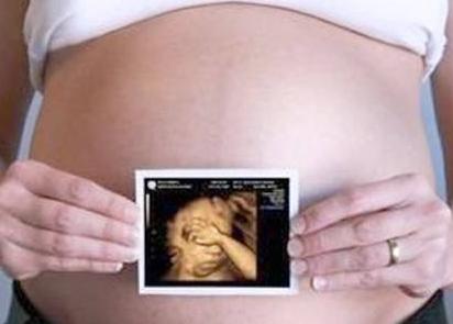 四维彩超的最佳时间