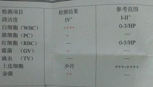 白带常规检查多少钱:白带常规检查的项目及注