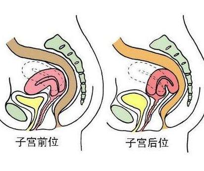 子宫后位是什么意思