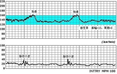胎心率多少正常