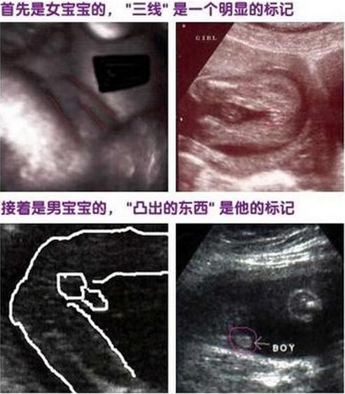 几个月能看出男孩女孩