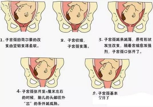 子宫底处于孕期最高点,而入盆后,子宫底便会回归到孕8月的高度,出现宫