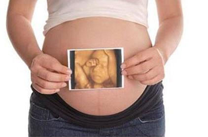 四维彩超最佳时间