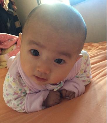 8个月宝宝拉稀怎么办